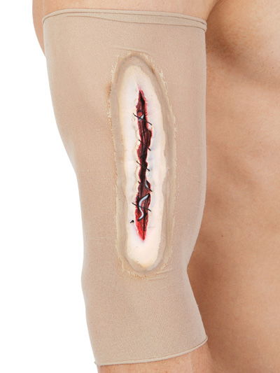 SCAR WOUND STOCKING WITH STITCHING